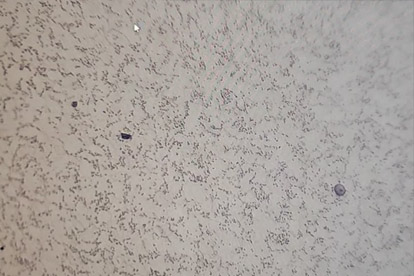 Metallographic examination -500 times metallographic examination